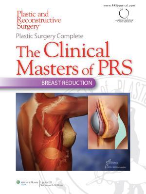 Download Plastic Surgery Complete: The Clinical Masters of Prs: Breast Reduction - Rod J Rohrich file in ePub